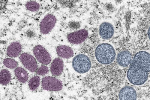 5 Loads Minimum! CDC Releases Sluttier Guidelines for Monkeypox Vaccine Eligibility